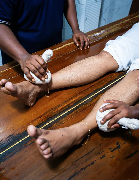 Varicose Veins Ayurvedic Treatment in Kerala